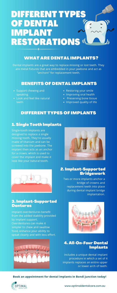 Dental implants can help improve your smile and your quality of life. They look and feel like natural teeth, so you don't have to worry about anyone knowing that you've had dental work done. Dental implants are not only strong and resistant to trauma but also incredibly durable. They will last a lifetime as long as you take good care of them by brushing and flossing regularly, visiting your dentist for regular checkups and dental cleanings, and avoiding foods that can damage oral health. If you have any questions or concerns about this topic, please contact Optimal Dental Care, a dental clinic in Woollahra, to schedule a checkup. For more information visit the website https://www.optimaldentalcare.com.au/

#dentistwoollahra #dentistbondi #bondidentist #dentalimplantsbondijunction #OptimalDentalCare