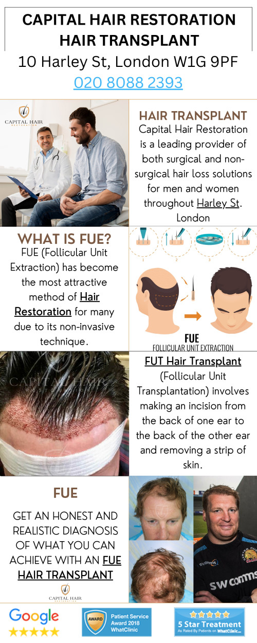 Hair Transplant treatment for men and women.  Professional hair restoration treatments for hair loss. FUE Hair Transplant treatment, FUT Hair Transplant treatment and Non-surgical hair treatments in Harley Street, London, United Kingdom.  https://www.capitalhairrestoration.co.uk/
 
#Hair transplant , #FUE hair transplant , #FUT hair transplant , #Hair transplant Harley Street
