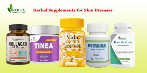 Herbal supplements for Skin Diseases can help reduce inflammation, itching, and other symptoms associated with common skin diseases. https://www.natural-health-news.com/common-skin-disease-and-treatment-using-herbal-supplements/