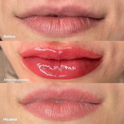 Check out these stunning lips before and after healing! The transformation from a pale shade to a natural pink lip blush is perfect for achieving a soft, everyday look. You can still get lip fillers with a lip blush and easily apply lipstick over it. I start with a gentle technique, allowing for further enhancement during the touch-up session. The possibilities are endless. Read: https://cosmetictattooingmelbourne.com.au/lip-tattooing/



#liptattooing #CosmeticTattooingMelbourne #cosmetictattooing #cosmetictattooistmelbourne