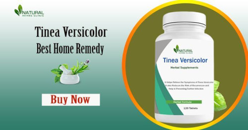 When it comes to dealing with common skin conditions like tinea versicolor, many individuals are seeking effective, Home Remedies for Tinea Versicolor that not only provide relief but also address the root cause of the issue. https://nycityus.com/home-remedies-for-tinea-versicolor-naturally-treat-tinea-versicolor/