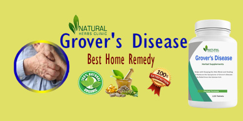 In this article, we, as experts in the field, will delve into the intricacies of Grover's Disease management through diet, natural treatments, herbal remedies, and holistic approaches to alleviate the symptoms and promote overall well-being. https://dribbble.com/shots/22554995-Grover-s-Disease-Management-Through-Diet