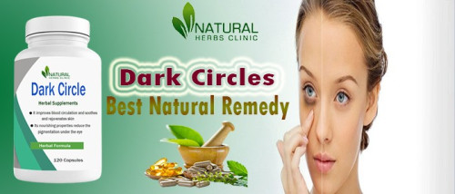 Natural Dark Circle Remedies, herbs, and even specially designed products like Maybelline's Instant Age Rewind Eraser Dark Circles Treatment can help you bid adieu to those stubborn dark circles. https://www.linkedin.com/pulse/transform-your-eyes-natural-dark-circle-remedies-jessica-sarah/