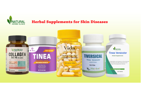 Herbal Supplement for Skin Diseases 2 780x470