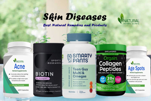 We will discuss the various benefits associated with using Skin Diseases Natural Remedies and how to make sure you are using them safely. https://www.natural-health-news.com/top-10-skin-diseases-natural-remedies-and-supplements/