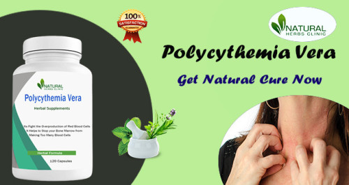 Incorporating certain lifestyle modifications and Home Remedies for Polycythemia Vera can be helpful in managing the symptoms and improving overall well-being. https://www.atoallinks.com/2023/some-well-known-polycythemia-vera-home-remedies-everyone-have-to-know/