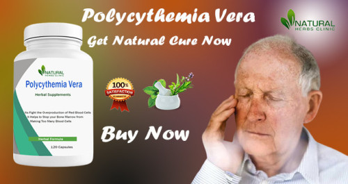 Treating Polycythemia Vera Naturally involves a holistic approach that encompasses lifestyle modifications and herbal remedies etc. https://outfitclothsuite.com/home-based-techniques-to-treating-polycythemia-vera-naturally/