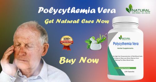 Polycythemia Vera (PV) is a rare blood disorder characterized by the overproduction of red blood cells in the bone marrow. While there is no known cure for PV, several Polycythemia Vera Natural Cure Remedies and lifestyle modifications can help manage the symptoms and improve overall well-being. https://topblogss.com/polycythemia-vera-natural-cure-managing-symptoms-and-promoting-well-being/