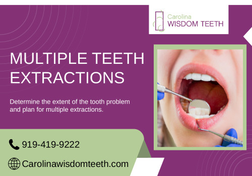 Our multiple teeth extractions provide a holistic solution for challenging dental issues, ensuring long-term oral health and functionality. Contact us now - 919-419-9222.