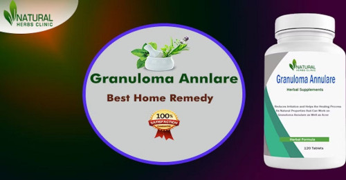 To treat a skin condition, Natural Remedies for Granuloma Annulare can be applied on regular basis to get a positive outcome. https://naturalherbsclinic.hashnode.dev/how-to-get-rid-of-my-granuloma-annulare-using-natural-remedies