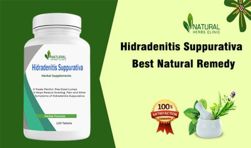 Diet can be a key component of Hidradenitis Suppurativa Natural Cure, which offers effective results in the skin condition's natural recovery. http://naturalherbsclinic.over-blog.com/2023/06/hidradenitis-suppurativa-foods-to-add-to-your-diet-for-natural-relief.html