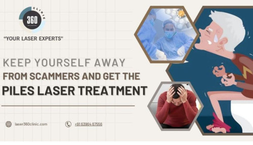 The best reason why patients choose piles laser treatment is the reasonable price. Due to its superior technique, most patients find laser treatment fantastic.
https://laser360clinic.com/keep-yourself-away-from-scammers-and-get-the-piles-laser-treatment/