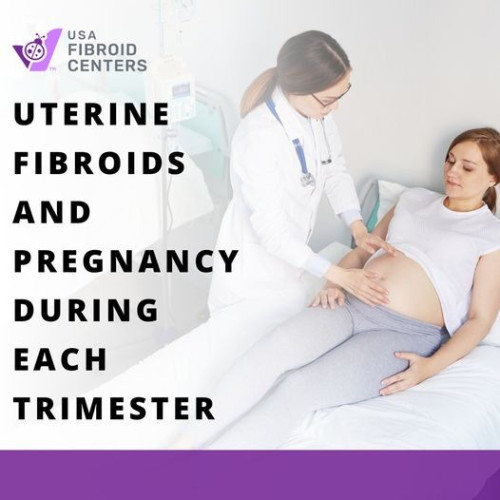 Fibroid Pain During Pregnancy: Pain is the most common symptom reported during the second and third trimesters, and it is often experienced with large fibroids that are over five centimeters. Learn more about fibroids in the first, second, and third trimesters

Read More-
https://www.usafibroidcenters.com/blog/how-fibroids-affect-each-trimester-of-pregnancy/