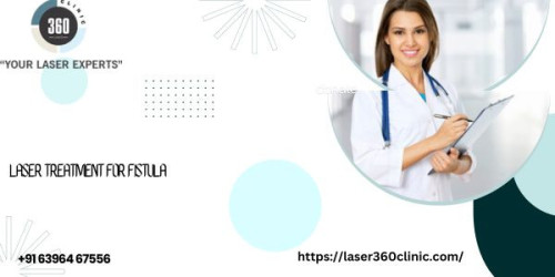 The cost of treatment is always a matter of concern for the patients who wish to undergo the best laser treatment for fistula.
https://laser360clinic.com/qualities-a-leading-clinic-for-fistula-treatment-must-have/